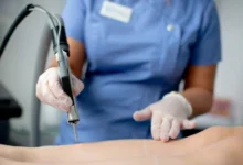 Finding Laser Hair Removal In Bristol: What To Look For Before You Book