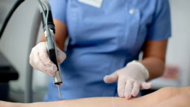 Finding Laser Hair Removal In Bristol: What To Look For Before You Book