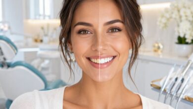 Brasssmile