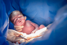Birth Injury Case in Pittsburgh, PA