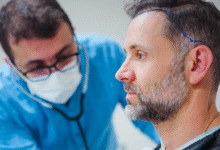 Hair Transplant