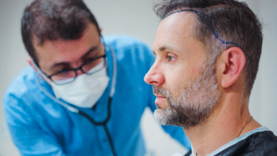 Hair Transplant