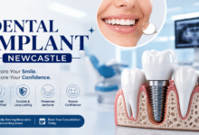 Dental Implant Newcastle