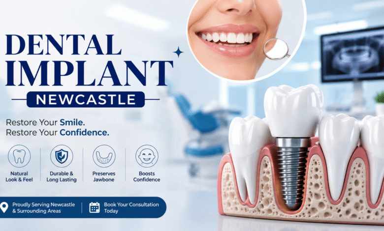 Dental Implant Newcastle