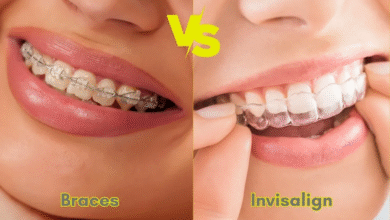 Invisalign vs Braces: Which Option Is Better for Your Smile?